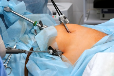 Advanced Laparoscopic Surgery