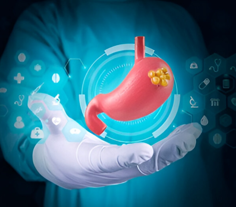 Gastro Cancer Surgery